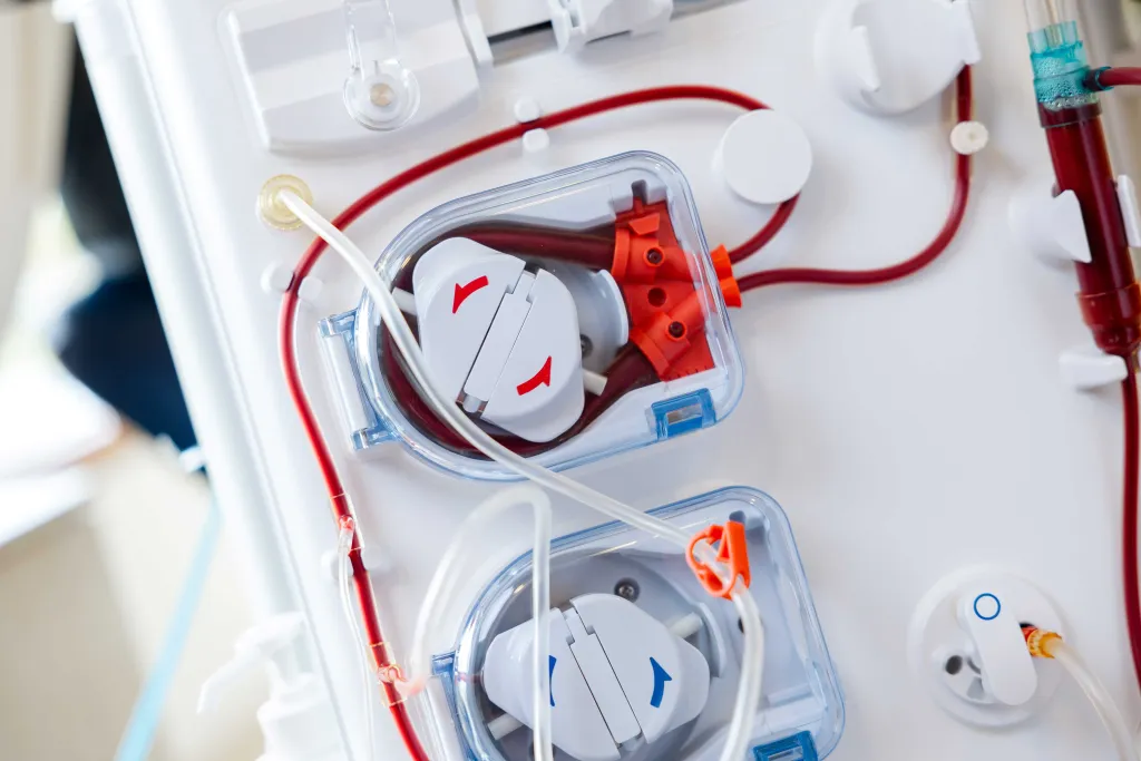Gloednieuwe dialysemachine